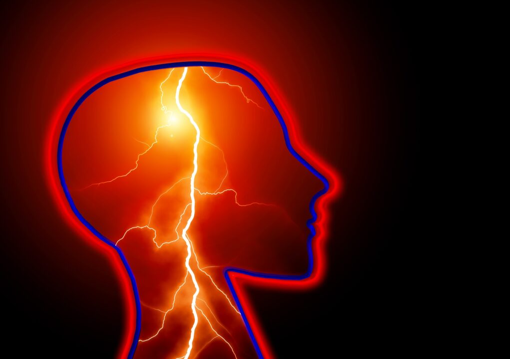 Seizures
