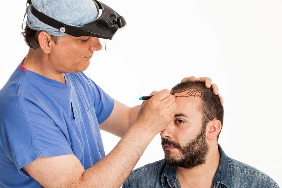 Hair Transplant - A Journey of Self-Discovery